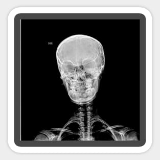 Skull X- Ray Sticker